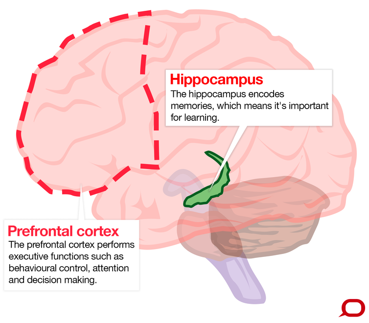 This is your brain 